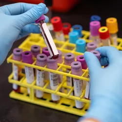 Photo of a clinical laboratory scientist wearing gloves and examining blood tube samples in a tube holder on a laboratory bench.