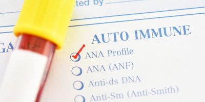 Photo of a blood test tube with a yellow cap next to a testing requisition for ANA testing for autoimmune disease.