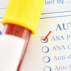 Photo of a blood test tube with a yellow cap next to a testing requisition for ANA testing for autoimmune disease.