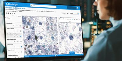 Photo of a clinical laboratory professional using the new Techcyte digital platform.