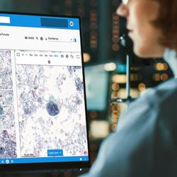 Photo of a clinical laboratory professional using the new Techcyte digital platform.