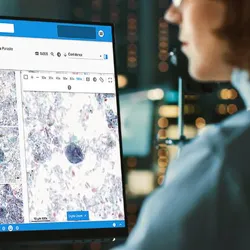 Photo of a clinical laboratory professional using the new Techcyte digital platform.