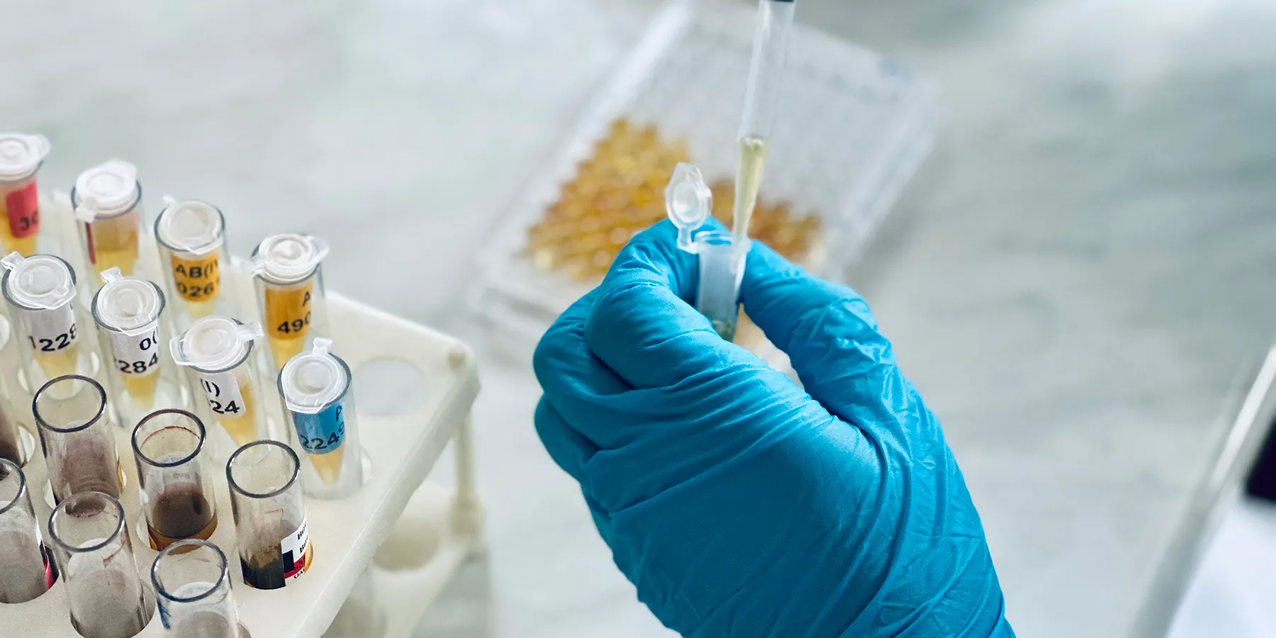 Close up photo of a clinical laboratory technician’s hand wearing a blue glove and pipetting cytomegalovirus samples into a PCR tube and 96-well plate.