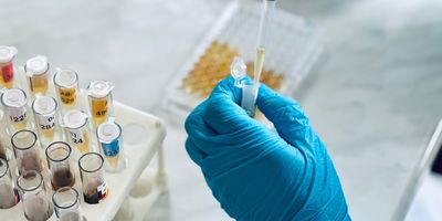 Close up photo of a clinical laboratory technician’s hand wearing a blue glove and pipetting cytomegalovirus samples into a PCR tube and 96-well plate.