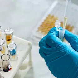 Close up photo of a clinical laboratory technician’s hand wearing a blue glove and pipetting cytomegalovirus samples into a PCR tube and 96-well plate.