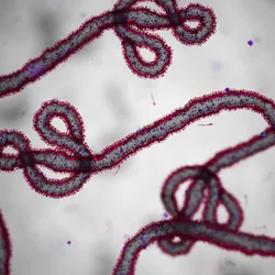 Photo of Ebola virus cells.