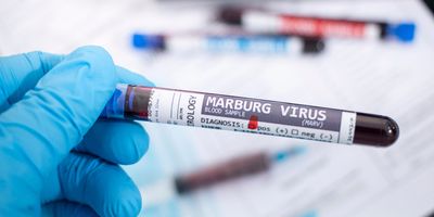 Photo close up of a clinical laboratory scientist’s hand wearing a blue glove and holding a positive blood tube sample of Marburg virus from laboratory testing.