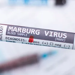 Photo close up of a clinical laboratory scientist’s hand wearing a blue glove and holding a positive blood tube sample of Marburg virus from laboratory testing.