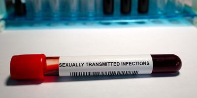  Photo of a blood test tube sample with the word ‘sexually transmitted infections’ on the label in a clinical laboratory.