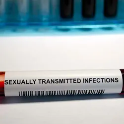  Photo of a blood test tube sample with the word ‘sexually transmitted infections’ on the label in a clinical laboratory.
