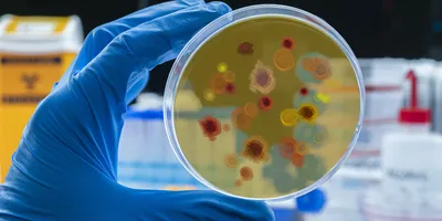 A laboratory scientist holds up a bacterial culture of Psedomonas aeruginosa on an agar plate.