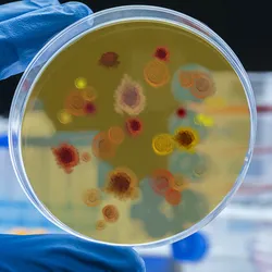 A laboratory scientist holds up a bacterial culture of Psedomonas aeruginosa on an agar plate.
