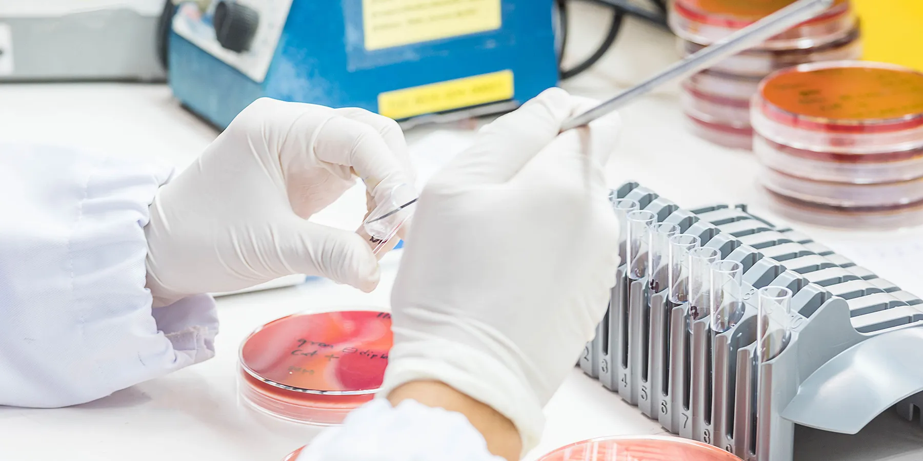  Close up photo of the hands of a laboratory scientist wearing white gloves and working on a bacterial culture in a biological safety cabinet.