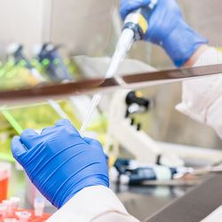 Prostate Clarity: A New Noninvasive Biomarker for Prostate Cancer Screening