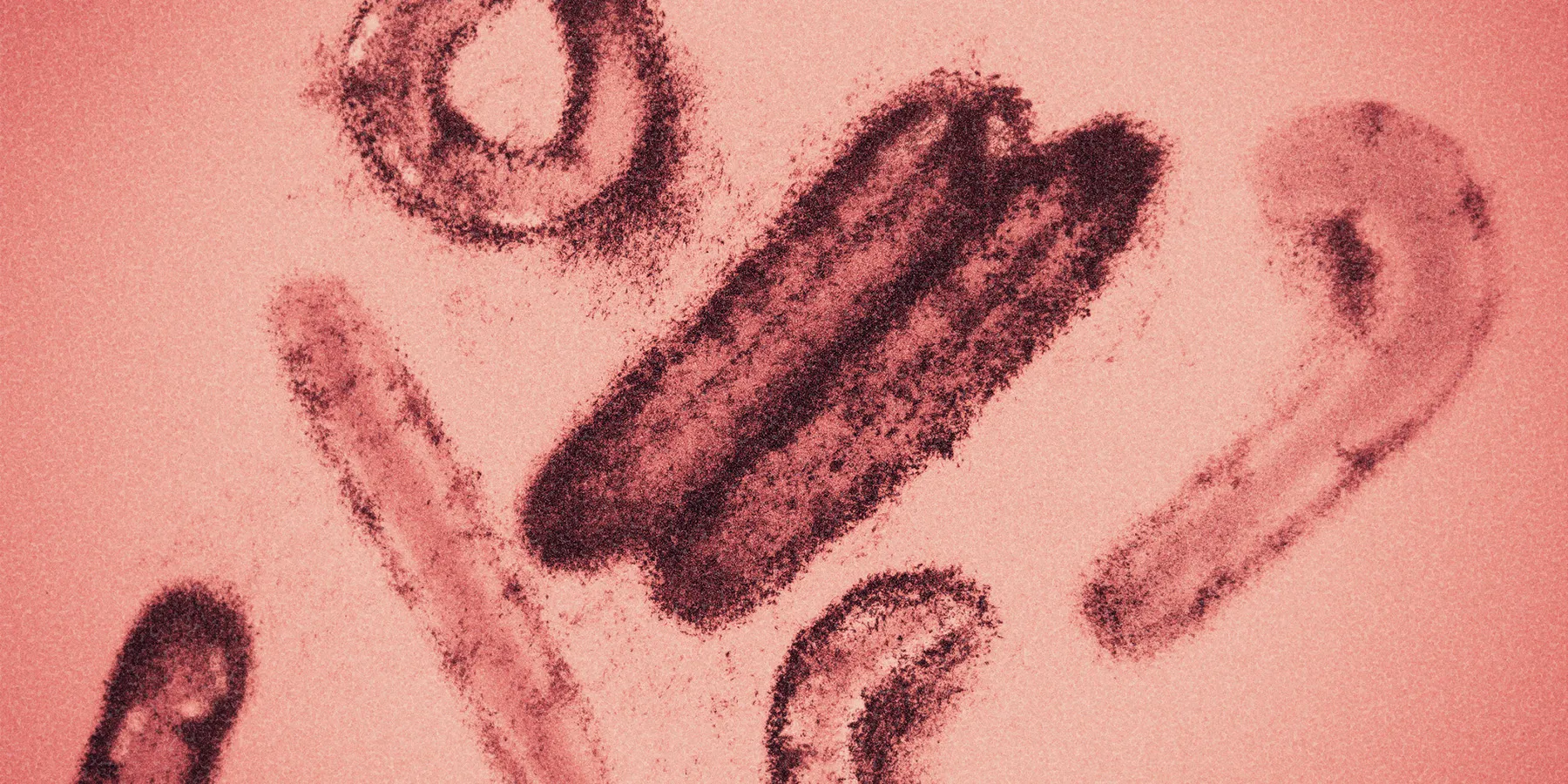  A microscopy photo of Marburg virus magnified. 