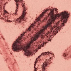 A microscopy photo of Marburg virus magnified.