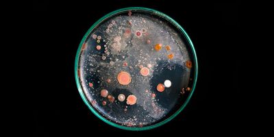 Photo of a nutrient agar plate with round colonies of orange and pink antimicrobial resistant organisms against a black background. 