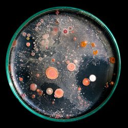 Photo of a nutrient agar plate with round colonies of orange and pink antimicrobial resistant organisms against a black background. 