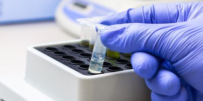 Photo of a clinical lab professional’s gloved hand holding a small clear tube of exosomes and extracellular vesicles in the laboratory.
