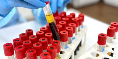 Photo of a clinical lab professionals gloved hand picking up a tube of blood to test it for sepsis in a hospital laboratory.