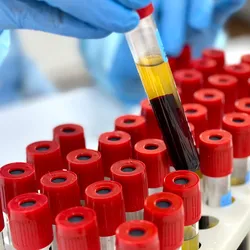 Photo of a clinical lab professionals gloved hand picking up a tube of blood to test it for sepsis in a hospital laboratory.