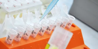 Photo of a clinical lab professional’s gloved hand holding a pipette and handling samples for an epigenetic marker of preeclampsia.