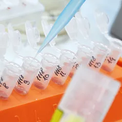 Photo of a clinical lab professional’s gloved hand holding a pipette and handling samples for an epigenetic marker of preeclampsia.