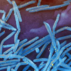 Scanning electron micrograph of human respiratory syncytial virus (RSV) virions (colorized blue) and tagged with antibodies (colorized yellow) against the virus’ fusion protein—the target of RSV vaccines.