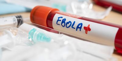 Photo of a blood collection tube labeled with the word ‘Ebola’ on a lab bench in a clinical laboratory