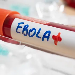 Photo of a blood collection tube labeled with the word ‘Ebola’ on a lab bench in a clinical laboratory