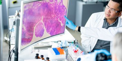 Photo of a clinical laboratory professional pointing to a digital pathology slide. Digital pathology adoption challenges continue for clinical labs, according to Labcorp.