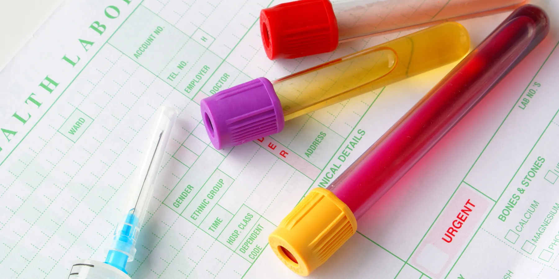 Photo of blood test tubes and a syringe lying sideways on top of a laboratory requisition form on a table.