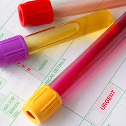 Photo of blood test tubes and a syringe lying sideways on top of a laboratory requisition form on a table.