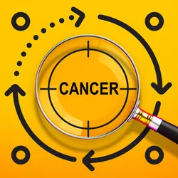 Illustration of a magnifying glass with the word “cancer” in the middle against a gold background.