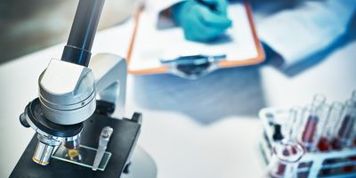 Photo of the hands of a medical laboratory scientist wearing gloves and a white lab coat and writing results on a clipboard next to a microscope in the lab.