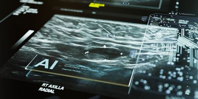 Clinical labs are poised to use computational pathology to support routine reporting and increase the efficiency of workflows, such as for cancer detection.