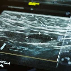 Computational Pathology Will Offset Clinical Lab Staffing Shortages by Streamlining Workflows