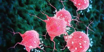 Illustration of cancer cells releasing circulating tumor DNA (ctDNA), which can be analyzed via blood-based genetic testing to identify mutations in childhood cancers.