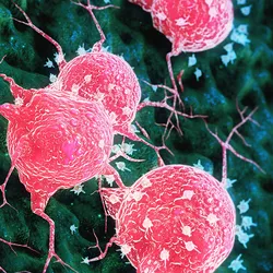 Illustration of cancer cells releasing circulating tumor DNA (ctDNA), which can be analyzed via blood-based genetic testing to identify mutations in childhood cancers.