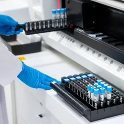 Automated clinical analyzer processes blood samples in a controlled lab environment, highlighting the need for proper containment in high-volume testing