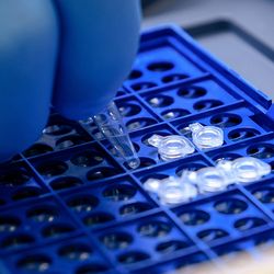 Gloved scientist pipetting samples into a microplate, representing precision DNA fragmentation, sample preparation, and next-generation sequencing (NGS) workflows