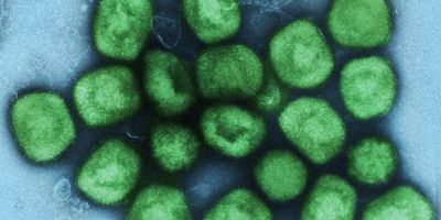Mpox virus particles (colorized electron microscopic image) 