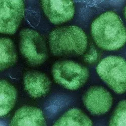 Mpox virus particles (colorized electron microscopic image)
