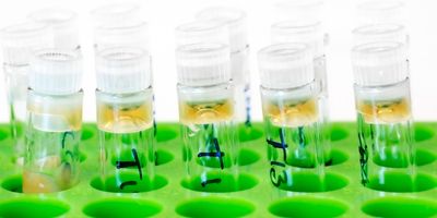 Photo of sample vials containing antibodies derived from in vitro libraries.