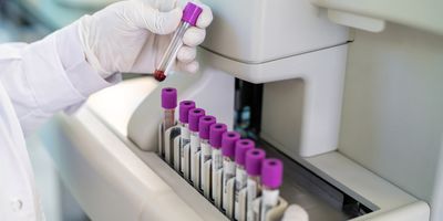 A close up photo of the gloved hand of a laboratory professional loading a genetic testing sample into lab instrument for cancer variant testing.