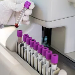 A close up photo of the gloved hand of a laboratory professional loading a genetic testing sample into lab instrument for cancer variant testing.