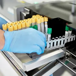 A clinical laboratory professional wearing a white lab coat and blue gloves loads CSF brain cancer samples for analysis.