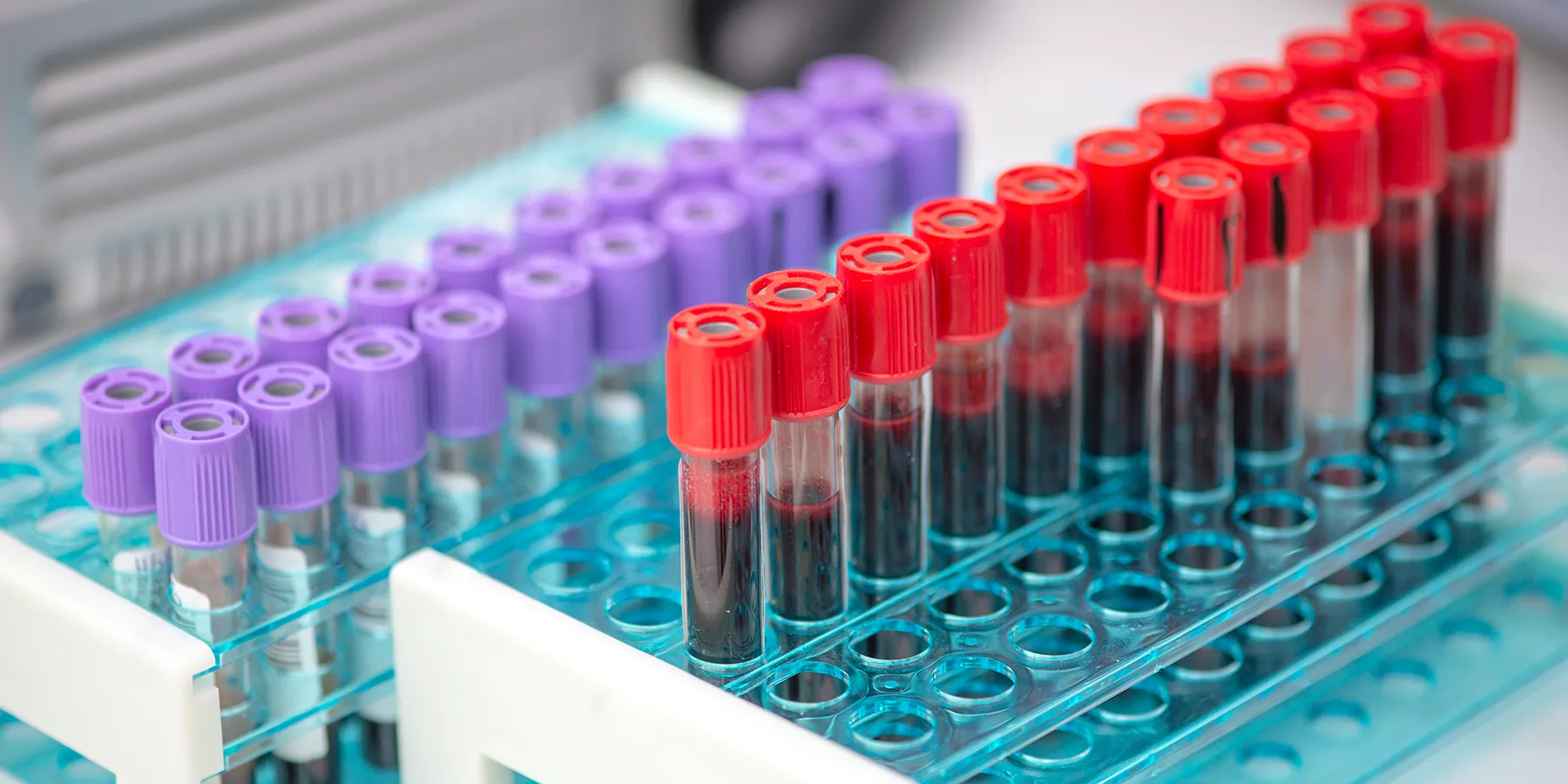 Photo of blood test tubes stored in a tube rack on a laboratory bench awaiting next-generation sequencing for cancer research.