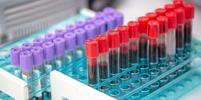 Photo of blood test tubes stored in a tube rack on a laboratory bench awaiting next-generation sequencing for cancer research.