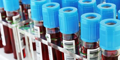 Photo of blood samples in test tubes with blue caps in a clinical laboratory awaiting testing for Alzheimer's disease with VeraBIND™ Tau.